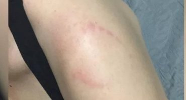 Foto: Reprodução/Redes sociais