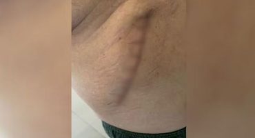 csm_erro-medico-cirurgia-vesicula-reproducao-arquivo-pessoal_7e4bf98994